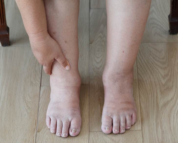 ۱۱ نشانه هشدار دهنده در بدن که نباید به آن ها بی اعتنا بود