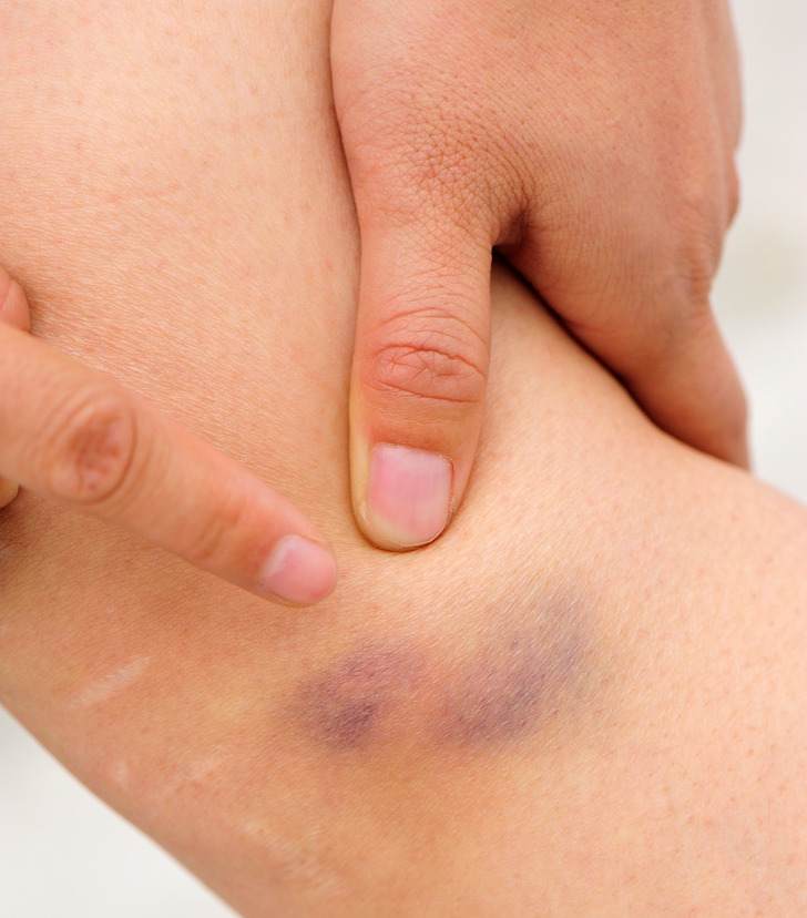 ۱۱ نشانه هشدار دهنده در بدن که نباید به آن ها بی اعتنا بود