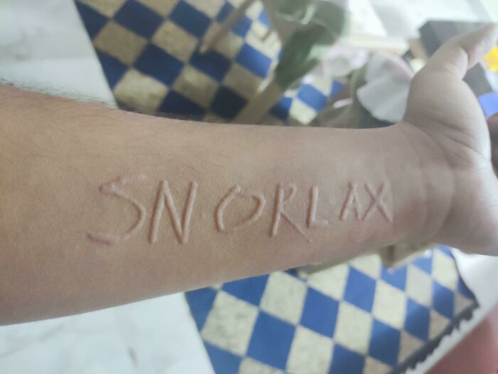 چند تصویر از نادرترین انسان‌های کره زمین