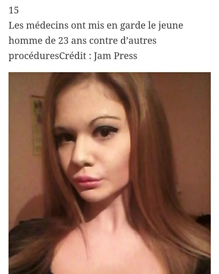 این زن بزرگ‌ ترین لب‌ های دنیا را دارد (+عکس)