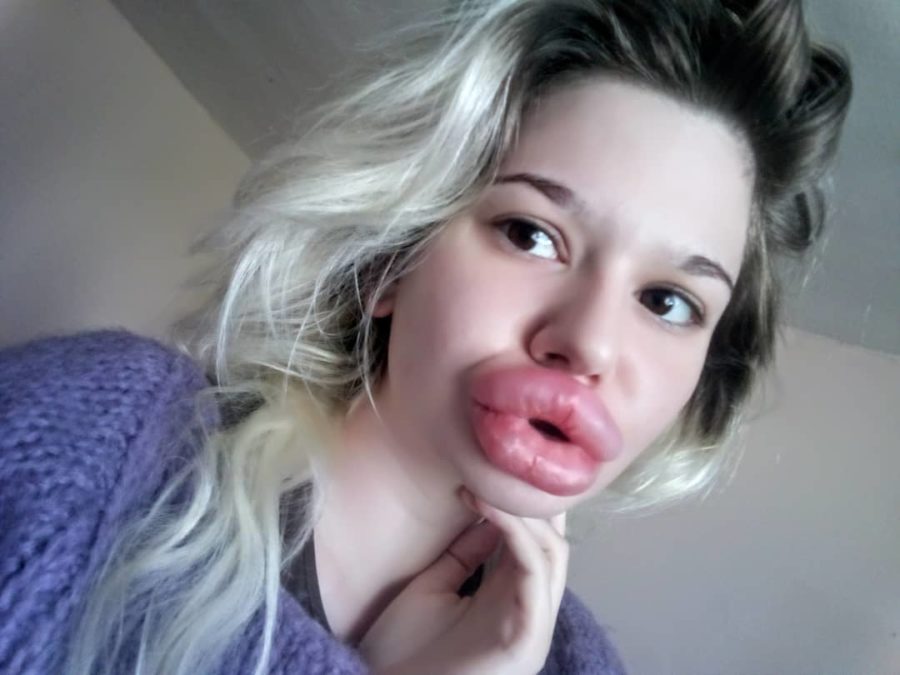 این زن بزرگ‌ ترین لب‌ های دنیا را دارد (+عکس)