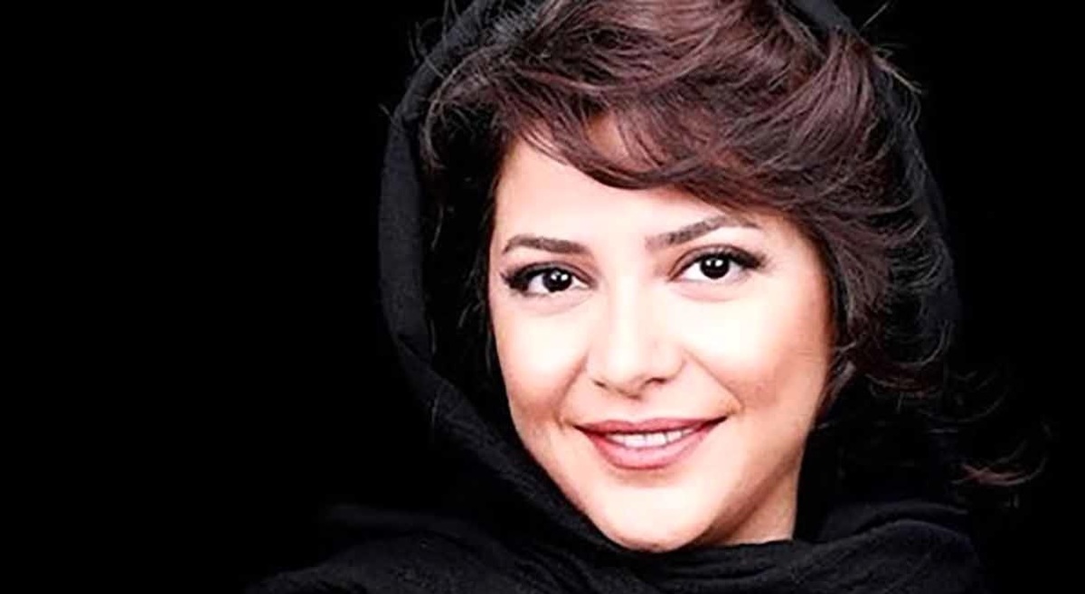 چهره طلای یاغی قبل و بعد از عمل زیبایی (عکس)