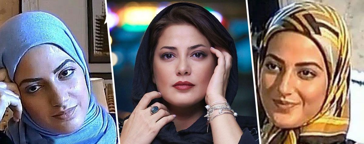 چهره غیر قابل تحمل طناز طباطبایی قبل از عمل زیبایی/ طاقت ندارید نبینید ! (+ عکس)