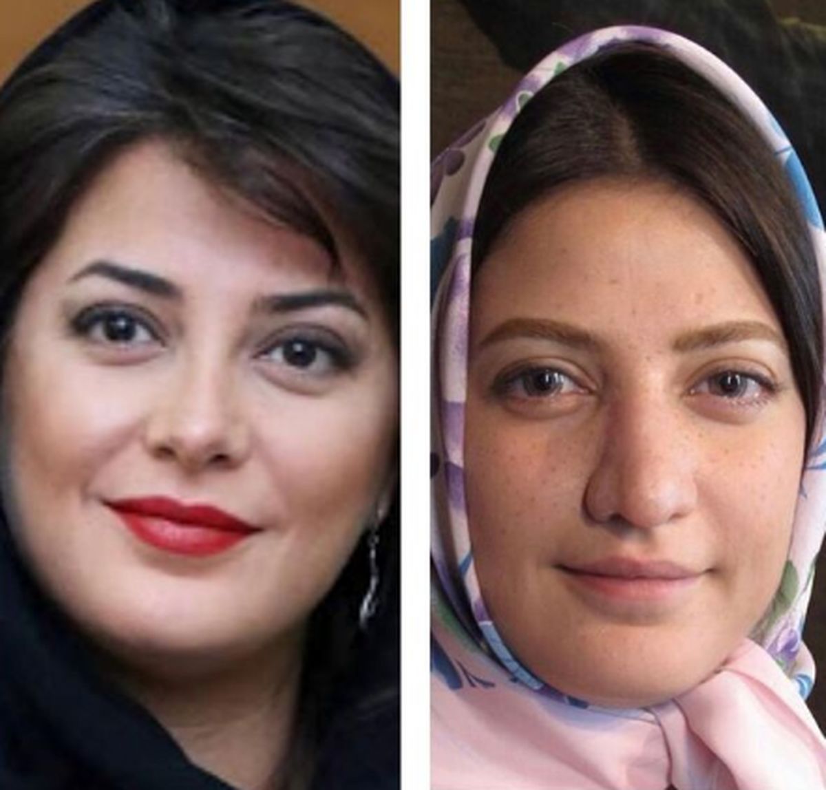 چهره غیر قابل تحمل طناز طباطبایی قبل از عمل زیبایی/ طاقت ندارید نبینید ! (+ عکس)