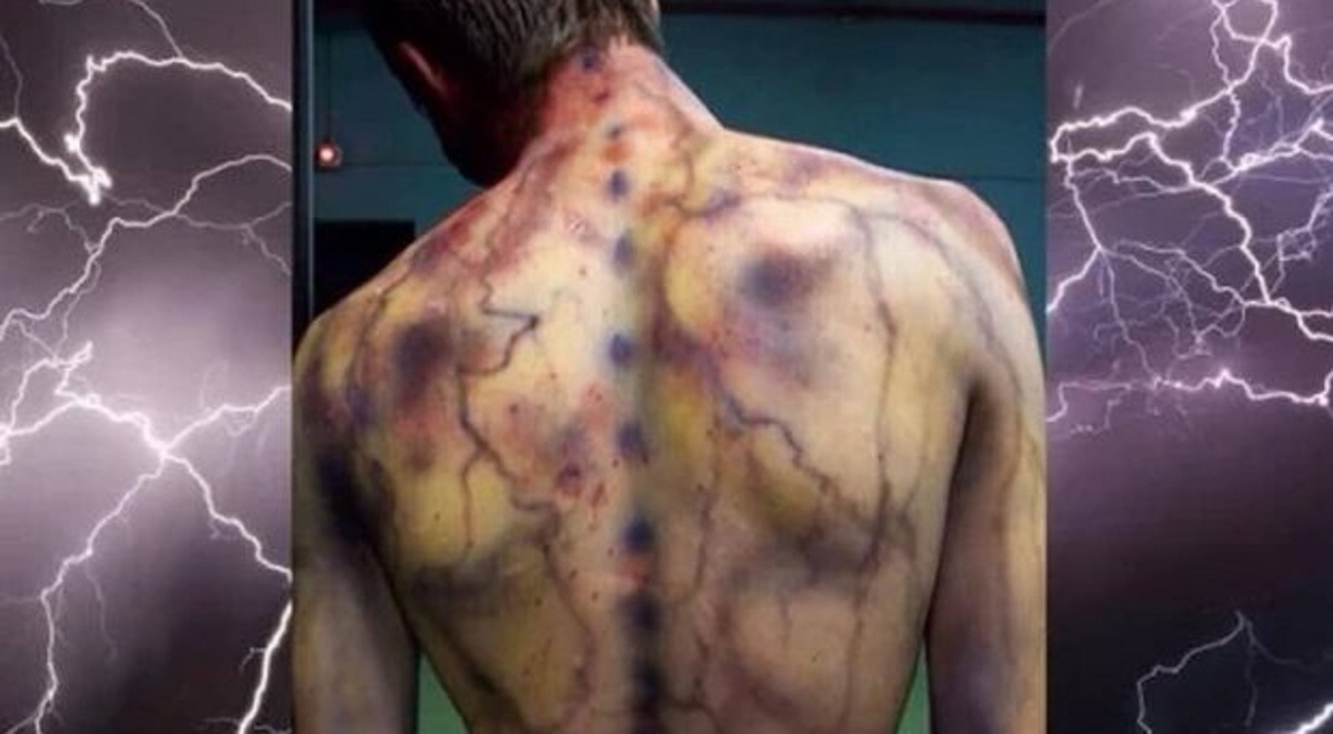 در زمان «رعد و برق» حمام یا دستشویی نروید، خطر مرگ در کمین است