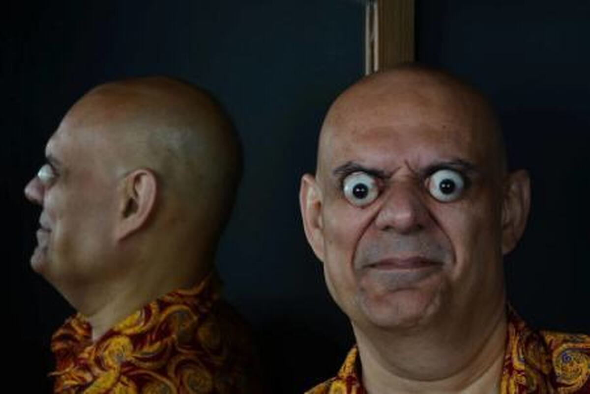 رکورددارِ چشم‌های بیرون زده از حدقه! (+عکس)