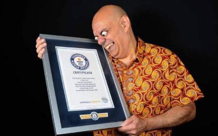 رکورددارِ چشمهای بیرون زده از حدقه! (+عکس) رکورددارِ چشمهای بیرون زده از حدقه! (+عکس)