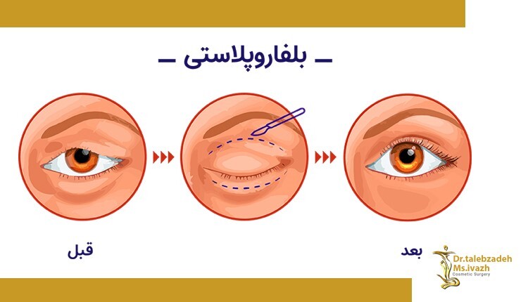 محبوب ترین عمل های زیبایی در ایران