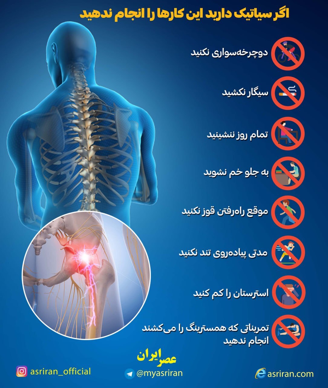 اگر سیاتیک دارید این کارها را انجام ندهید (اینفوگرافیک)