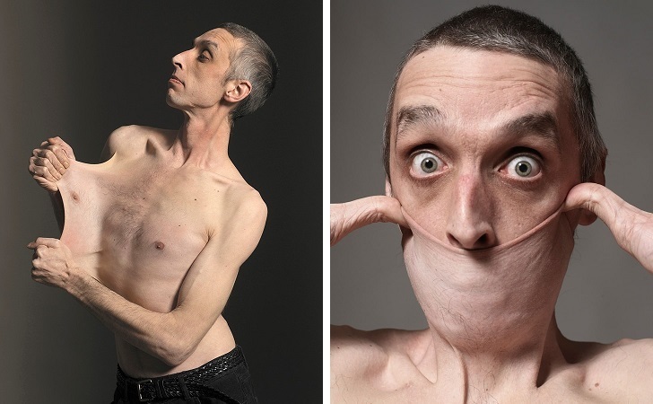 ۱۰ انسان عجیب الخلقه که گویی از دل فیلم های تخیلی بیرون آمده اند