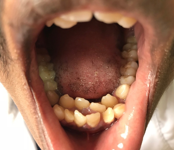 ۱۰ انسان عجیب الخلقه که گویی از دل فیلم های تخیلی بیرون آمده اند