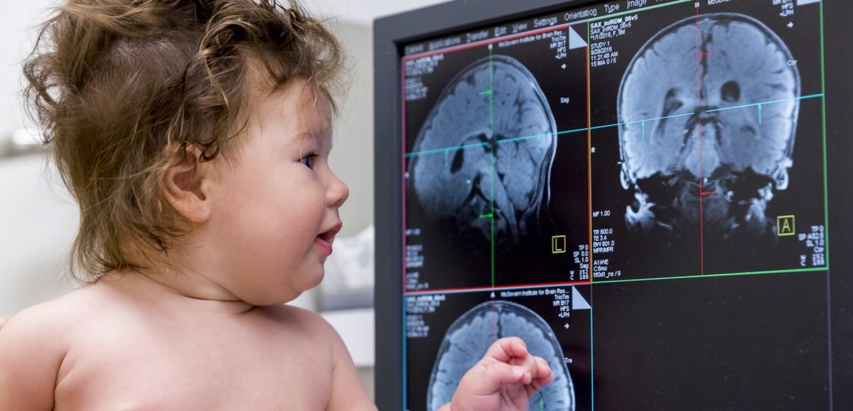مغز کودک تا 6 سالگی؛ همه چیز درباره رشد و تکامل ذهنی(+اینفوگرافی)