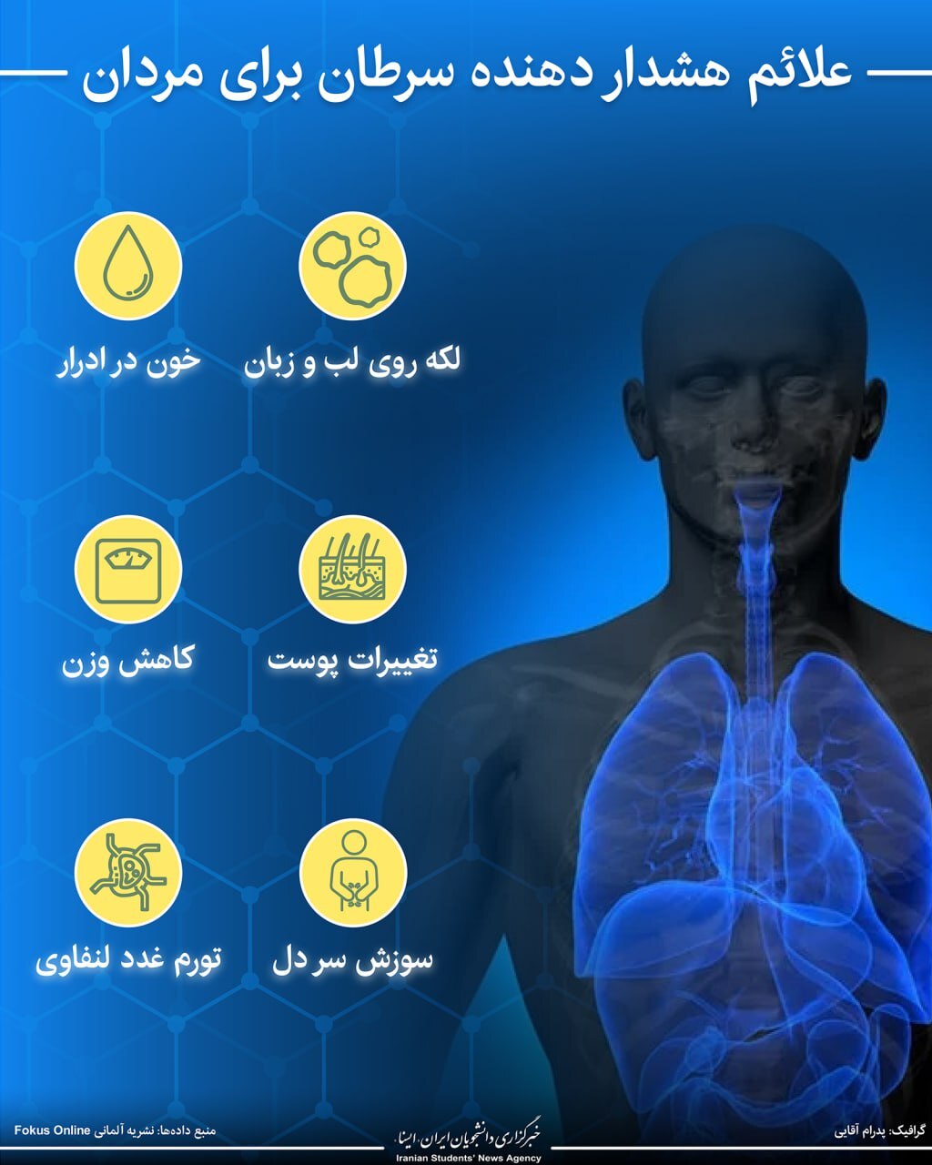 علائم هشداردهنده سرطان برای مردان