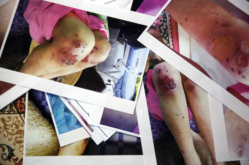 resized 576388 287 - شکنجه یک زن و ۲ دخترش/ آنها ۲۱ روز غذا نخوردند اما هنوز زنده‌اند+تصاویر