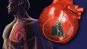 هر درد قفسه سینه حمله قلبی نیست! راه تشخیص را یاد بگیرید
