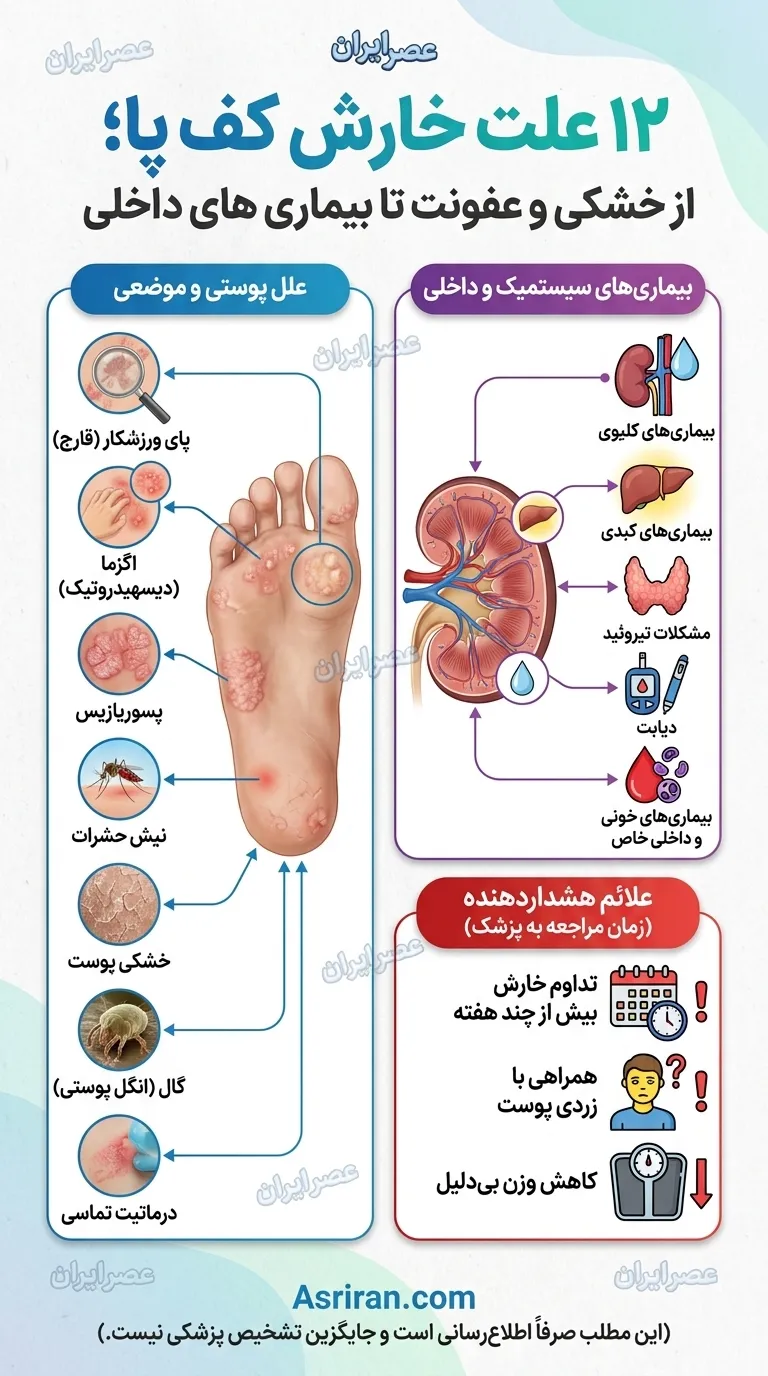 خشکی کف پا خشکی کف پا