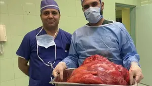 خارج کردن توده ۲۳ کیلویی از شکم خانم تبریزی
