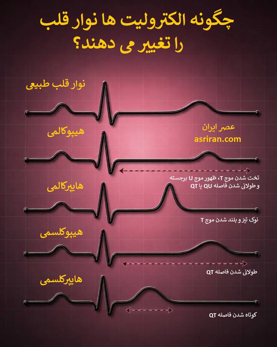 اینفوگرافیک تاثیر الکترولیت ها بر نوار قلب اینفوگرافیک تاثیر الکترولیت ها بر نوار قلب