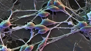 کشف تفاوت فعالیت ژنی در مغز زنان و مردان با تحلیل یک میلیون سلول