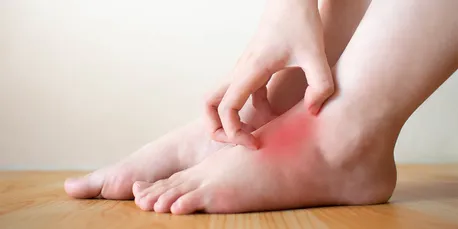 8 متخصص طبیعی برای مقابله با التهاب