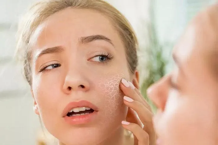 علائم خشکی پوست صورت علائم خشکی پوست صورت