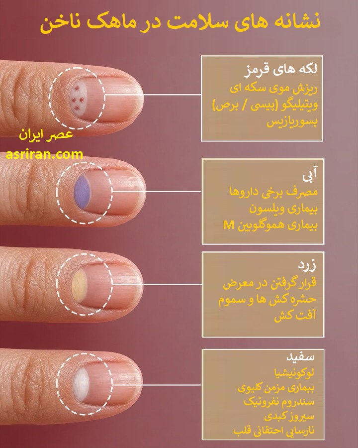اینفوگرافیک نشانه های سلامت در ماهک ناخن