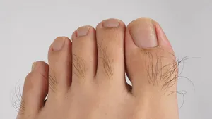 تراکم موی انگشت پا از کدام راز سلامت بدن خبر می دهد؟!