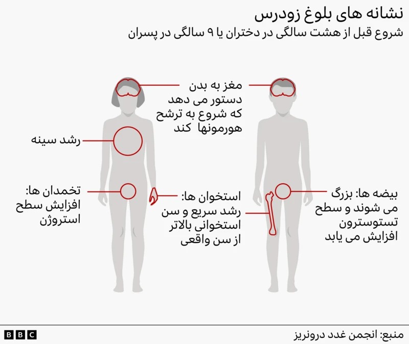 نشانه های بلوغ زودرس نشانه های بلوغ زودرس